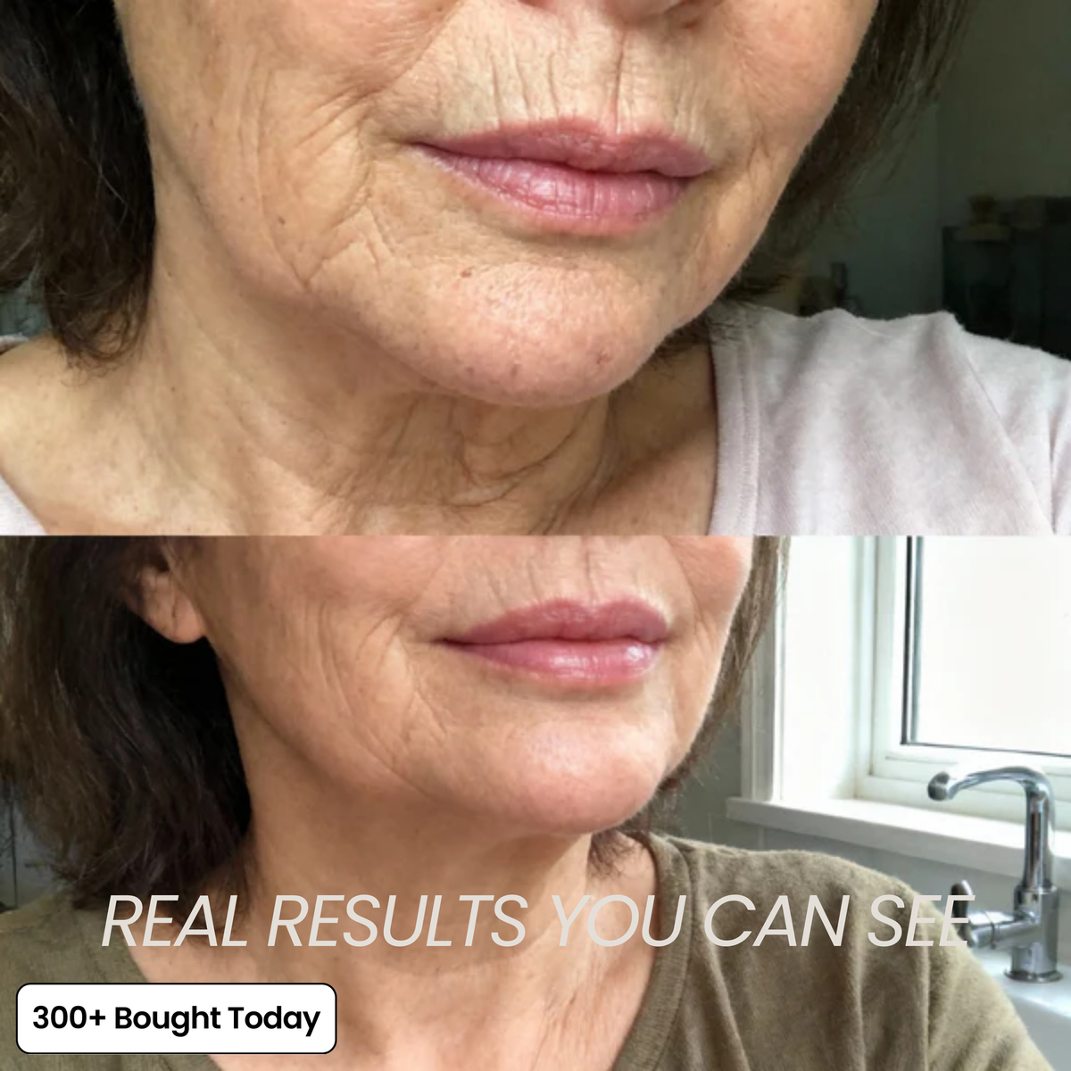 PDRN Collagen Plump & Repair Balm with Volufiline