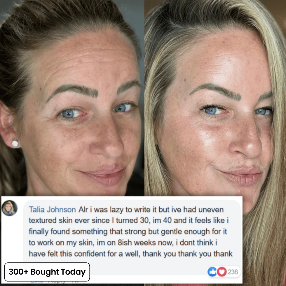 PDRN Collagen Plump & Repair Balm with Volufiline