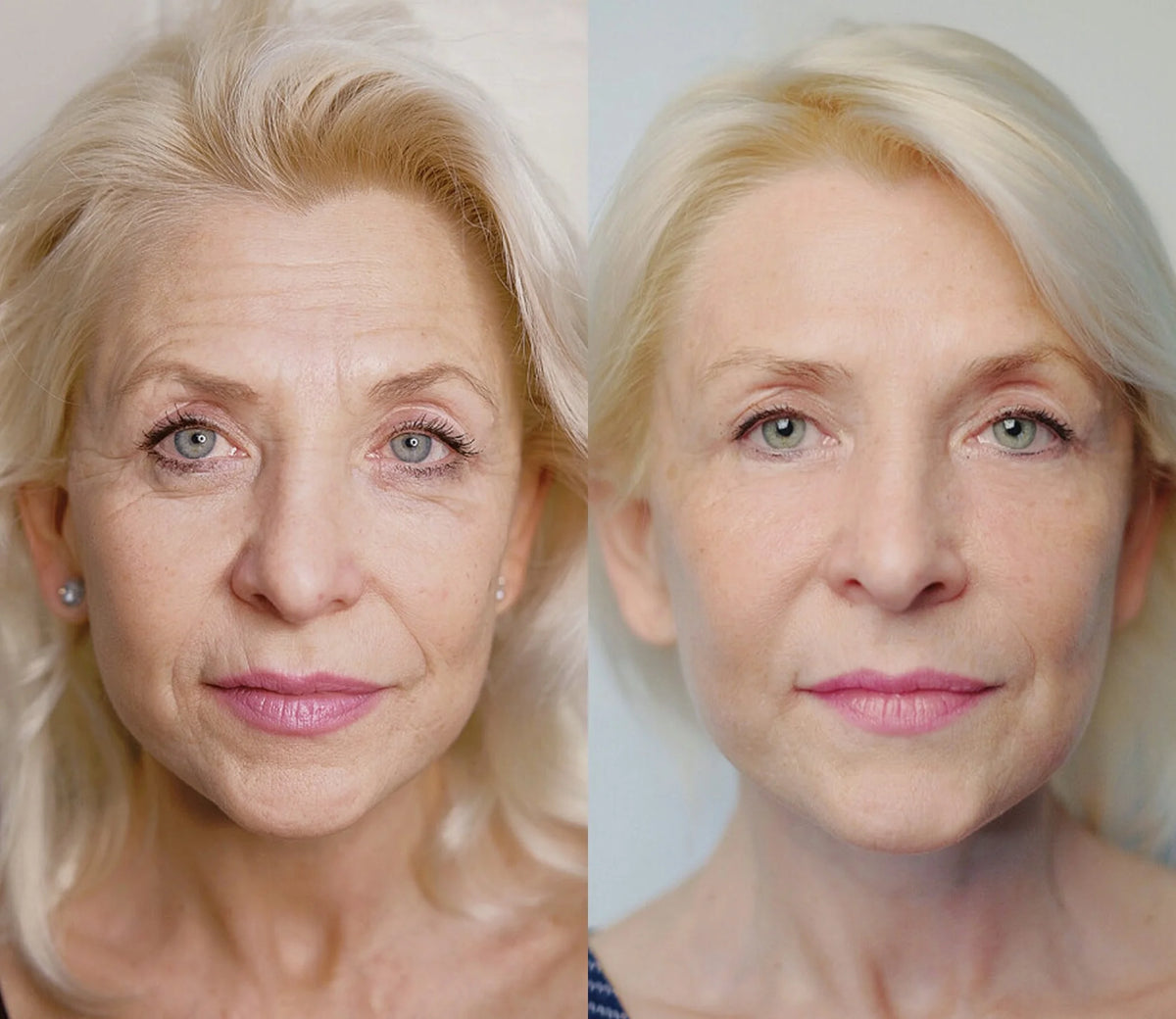 LOVILDS® Advanced Serum-7-Day Younger Looking Skin