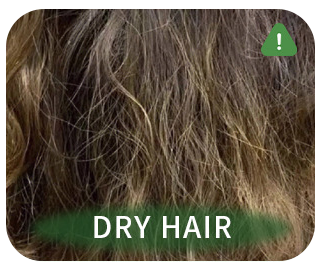 Dry Hair