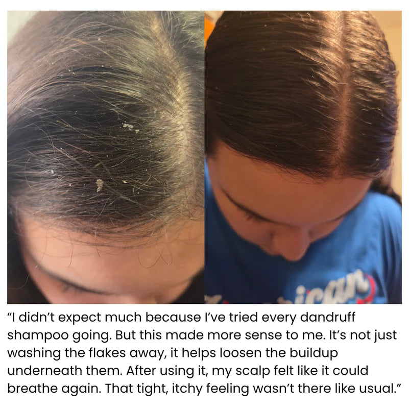 Korean Scalp Revival Bar