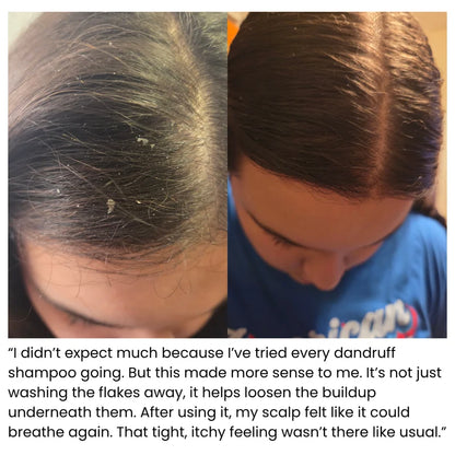 Korean Scalp Revival Bar
