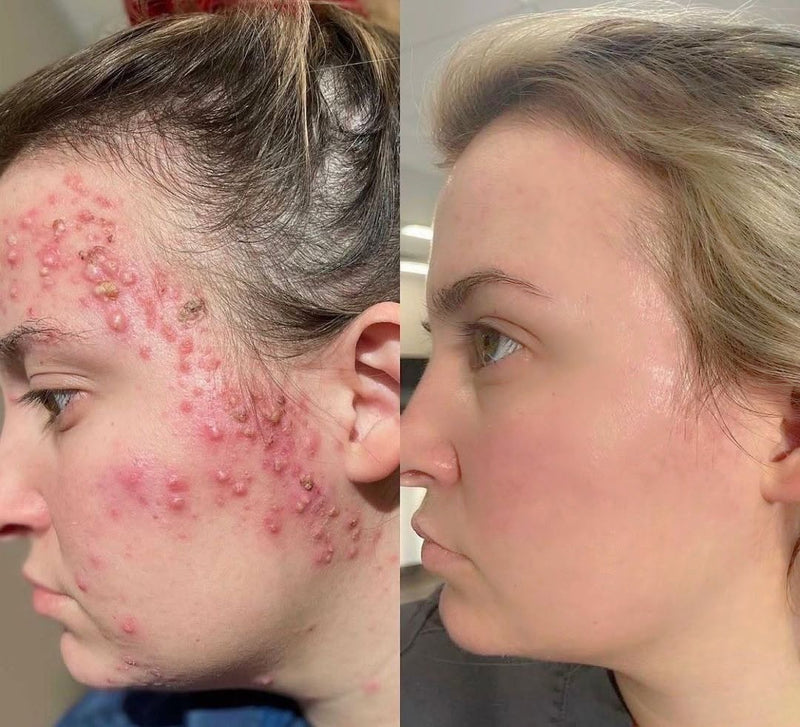 Rachel, 37