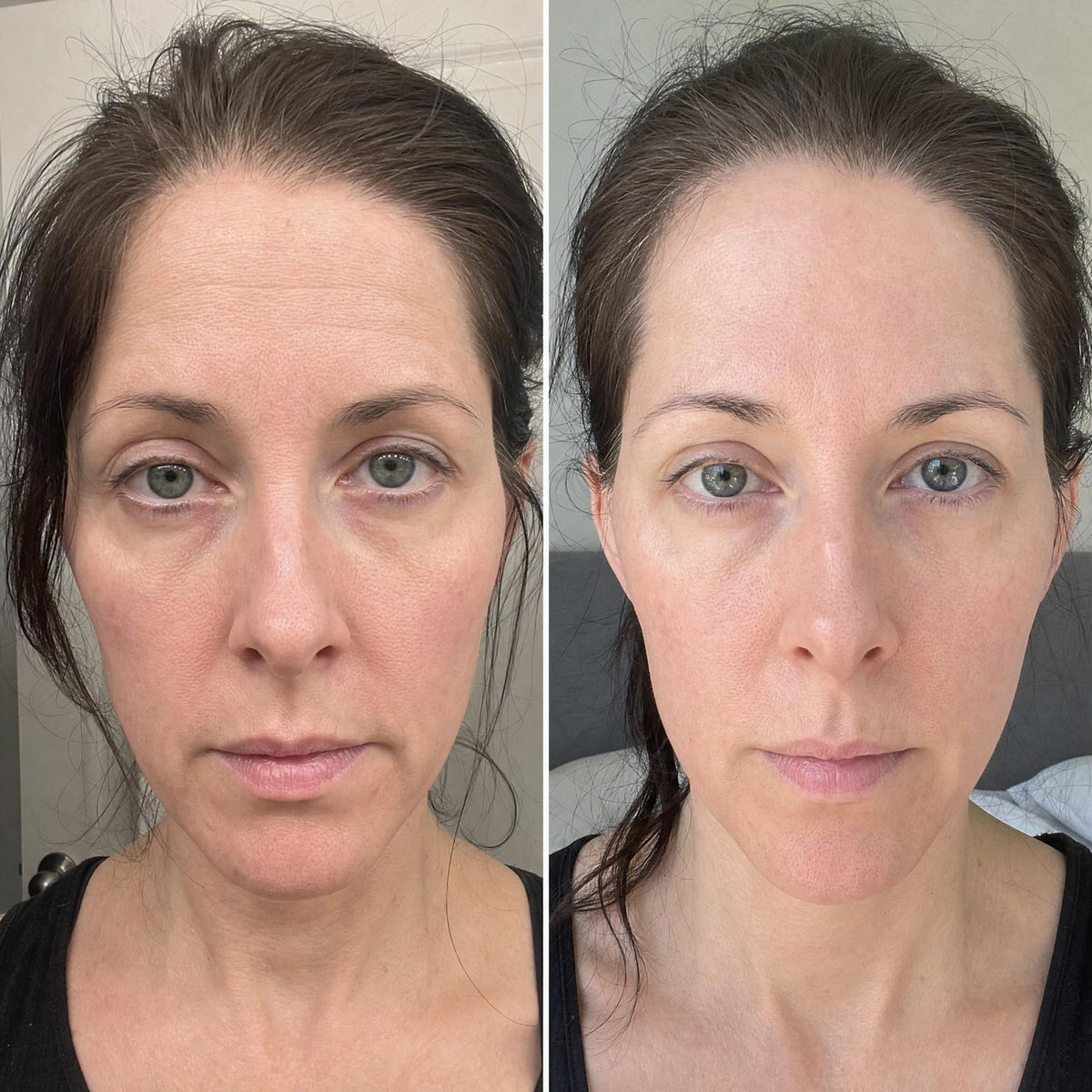 Collagen Silk Peptide Ampoule Serum 2.0