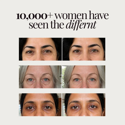 30-Minute Emergency Depuffing & Firming Eye Treatment