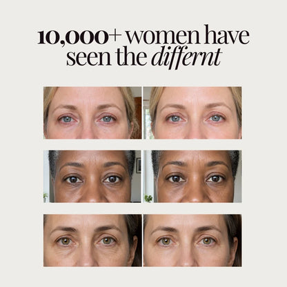 30-Minute Emergency Depuffing & Firming Eye Treatment
