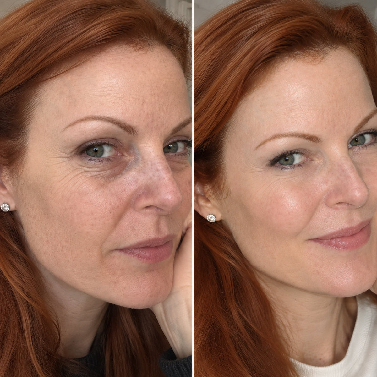 Eye Renewal Crème