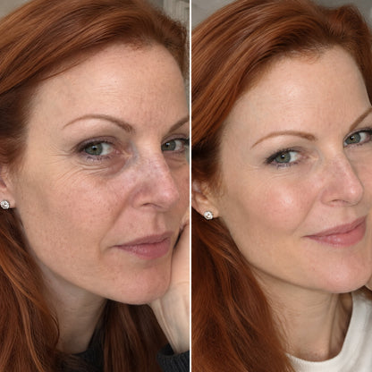 Eye Renewal Crème