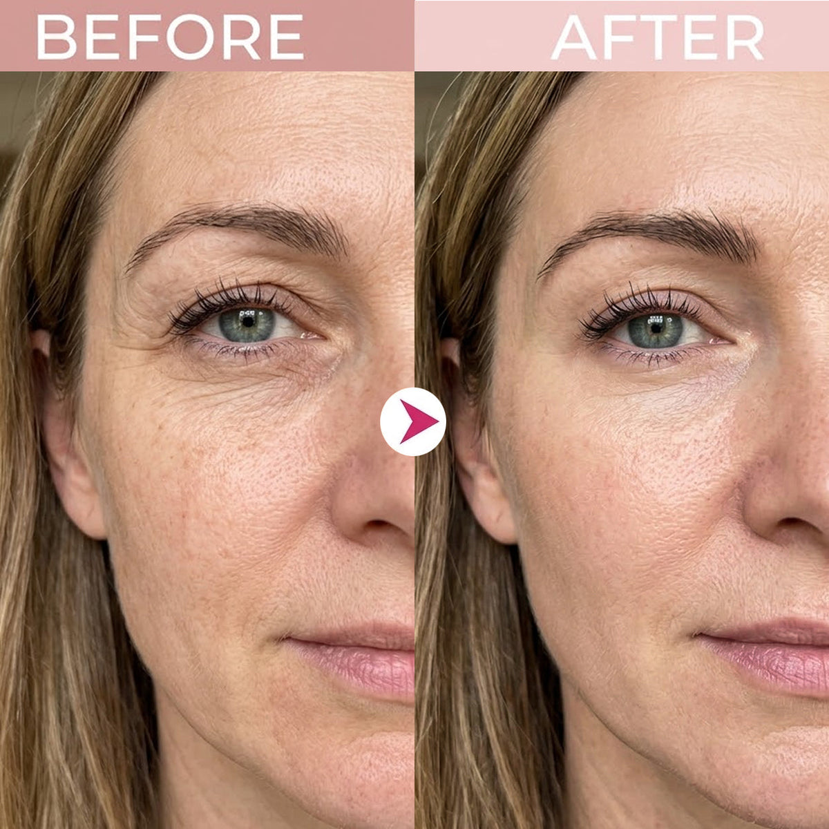 Eye Renewal Crème