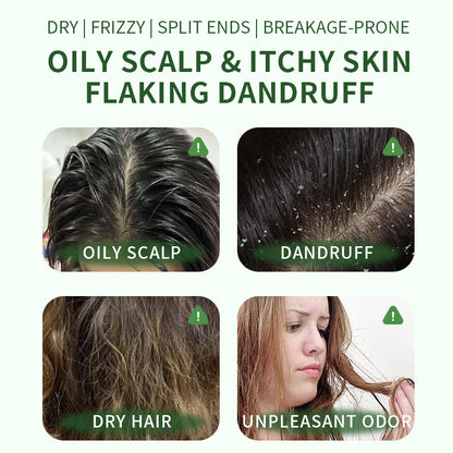 Korean Scalp Revival Bar