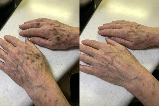 Linda M., 71